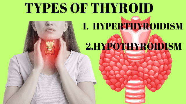 थाइरोइड का रामबाण इलाज